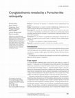 Research paper thumbnail of Cryoglobulinemia revealed by a Purtscher-like retinopathy