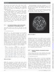 Research paper thumbnail of 323 Late infantile neuronal ceroid lipofuscinosis masquerading as spinocerebellar ataxia