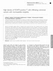 Research paper thumbnail of High density of FOXP3-positive T cells infiltrating colorectal cancers with microsatellite instability