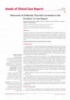 Research paper thumbnail of Metastasis of Follicular Thyroid Carcinoma to the Vertebra: A Case Report