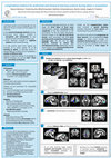 Research paper thumbnail of Longitudinal evidence for prefrontal and temporal learning systems involved during adult L2 acquisition