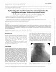 Research paper thumbnail of Full metal jacket: transfemoral aortic valve implantation for regurgitant valve after endovascular aortic repair†