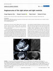 Research paper thumbnail of Angiosarcoma of the right atrium and right ventricle