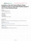 Research paper thumbnail of Evaluation of the Soft Tissue Effects of Early Childhood Caries on Oral Health-Related Quality of Life: A Cross-Sectional Study