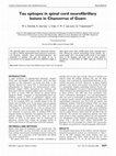 Research paper thumbnail of Tau epitopes in spinal cord neurofibrillary lesions in Chamorros of Guam