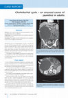 Research paper thumbnail of Choledochal cysts - an unusual cause of jaundice in adults