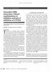 Research paper thumbnail of Tamoxifen-SSRIs interaction: clinical manifestations of inhibition and lack of inhibition of CYP2D6