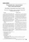 Research paper thumbnail of Case Report of Generalized Lichen Planus in a Child