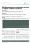 Research paper thumbnail of Nasal Manifestations in Granulomatosis with Polyangiitis: A Case Report and Review of the Literature