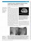 Research paper thumbnail of Congenital anterior mediastinal teratoma causing severe airway compression in a neonate