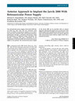 Research paper thumbnail of Anterior Approach to Implant the Jarvik 2000 With Retroauricular Power Supply