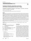 Research paper thumbnail of Visualization of thrombus using iterative reconstruction and maximum intensity projection of thin-slice CT images