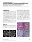 Research paper thumbnail of 16 Month-Old Female with Intraventricular Mass