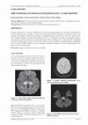 Research paper thumbnail of MRI Findings in Dengue Encephalitis : A Case Report