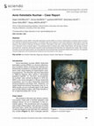 Research paper thumbnail of Acne Keloidalis Nuchae – Case Report