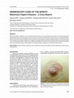 Research paper thumbnail of Dermoscopy Case of the Month