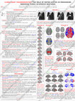 Research paper thumbnail of The role of motor cortex in processing observed iconic co-speech gestures