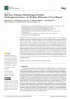 Research paper thumbnail of Bile Duct Lithiasis Mimicking a Perihilar Cholangiocarcinoma—An Endless Dilemma: A Case Report