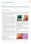 Research paper thumbnail of Pyogenic Granuloma ( PG )-Common Lesion at Uncommon Site Case Report