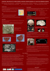 Research paper thumbnail of Cranial trauma on a child from a double roman burial at Augusta Emerita (Spain)