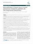 Research paper thumbnail of Microcalcifications in breast cancer: an active phenomenon mediated by epithelial cells with mesenchymal characteristics