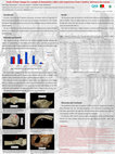 Research paper thumbnail of Study of bone changes in a sample of shoemakers, tailors and seamstresses from Coimbra: inferences for activity