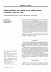 Research paper thumbnail of Biomicroscopia ultra-sônica em esclerectomia profunda: relato de caso