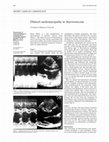 Research paper thumbnail of Dilated cardiomyopathy in thyrotoxicosis