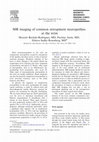 Research paper thumbnail of MR imaging of common entrapment neuropathies at the wrist