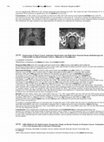 Research paper thumbnail of AIRO PROS 01-02 multi-centric prospective study on rectal toxicity in prostate cancer: evaluation of a pre-trial dummy-run in rectum contouring