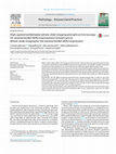 Research paper thumbnail of High agreement between whole slide imaging and optical microscopy for assessment of HER2 expression in breast cancer. Whole slide imaging for the assessment of HER2 expression