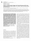 Research paper thumbnail of Incidence of additional genetic changes in the TEL and AML1 genes in DCOG and COALL-treated t(12;21)-positive pediatric ALL, and their relation with drug sensitivity and clinical outcome