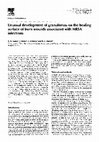 Research paper thumbnail of Unusual development of granulomas on the healing surface of burn wounds associated with MRSA infections