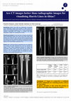 Research paper thumbnail of Are CT images better than radiographic images for visualising Harris Lines in tibiae?