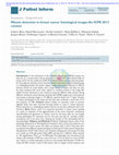 Research paper thumbnail of Mitosis detection in breast cancer histological images An ICPR 2012 contest