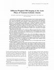 Research paper thumbnail of Diffusion-weighted MR imaging in the acute phase of transient ischemic attacks