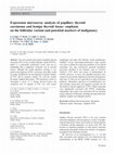 Research paper thumbnail of Expression microarray analysis of papillary thyroid carcinoma and benign thyroid tissue: emphasis on the follicular variant and potential markers of malignancy