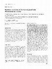 Research paper thumbnail of Papillary carcinoma of the thyroid gland with fibromatosis-like stroma