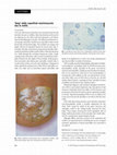 Research paper thumbnail of Absence of Epstein-Barr virus and human herpesvirus-6 in pityriasis lichenoides and plaque parapsoriasis