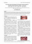 Research paper thumbnail of Over denture with ceka attachment: An alternative treatment modality to rehabilitate partially edentulous condition -A case report