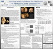 Research paper thumbnail of Activity levels influence the likelihood of developing knee osteoarthritis