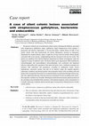 Research paper thumbnail of A case of silent colonic lesions associated with streptococcus gallolyticus, bacteremia and endocarditis