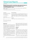 Research paper thumbnail of Masquerading bundle branch block obscuring the diagnosis of Brugada syndrome: an electrocardiographic and vectorcardiographic study