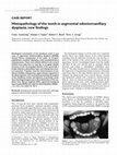 Research paper thumbnail of Histopathology of the teeth in segmental odontomaxillary dysplasia: new findings