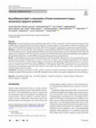 Research paper thumbnail of Neurofilament light is a biomarker of brain involvement in lupus and primary Sjögren’s syndrome