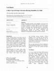 Research paper thumbnail of A Rare Case of Ewing’s Sarcoma affecting Mandible of a Child