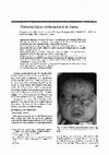 Research paper thumbnail of Neonatal lupus erythematosus in Japan