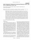 Research paper thumbnail of ESE-1 is Required to Maintain the Transformed Phenotype of MCF-7 and ZR-75-1 Human Breast Cancer Cells