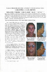 Research paper thumbnail of Nasal prosthesis for a patient with basal cell carcinoma: A case report