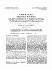 Research paper thumbnail of Abdominal wall sinus: a late complication of gallstone spillage during laparoscopic cholecystectomy